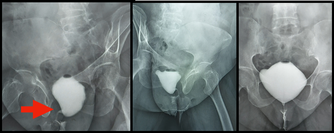 Difficult Case Fig 2