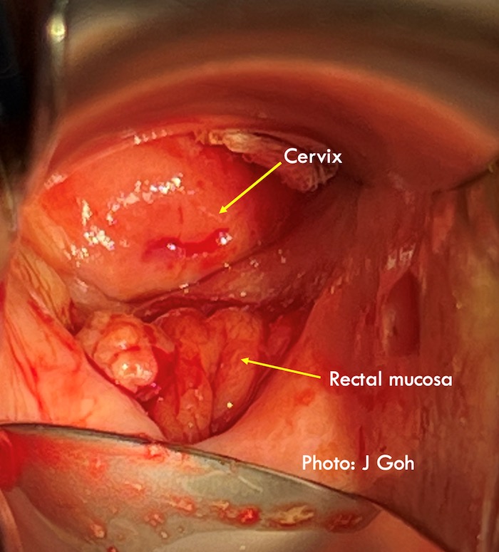 Goh figure 3