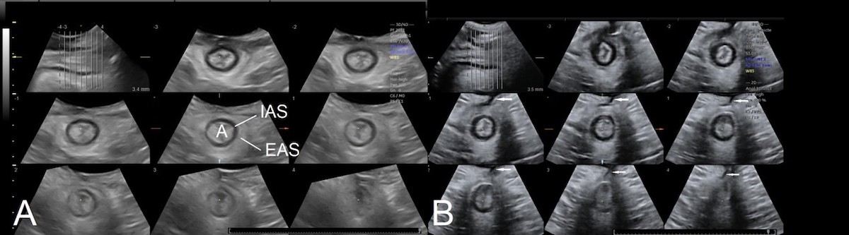 spotlight 17 3 Fig 3 Shek