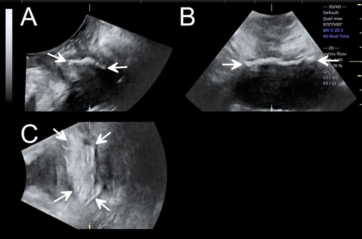 spotlight 17 3 Fig 4 Shek