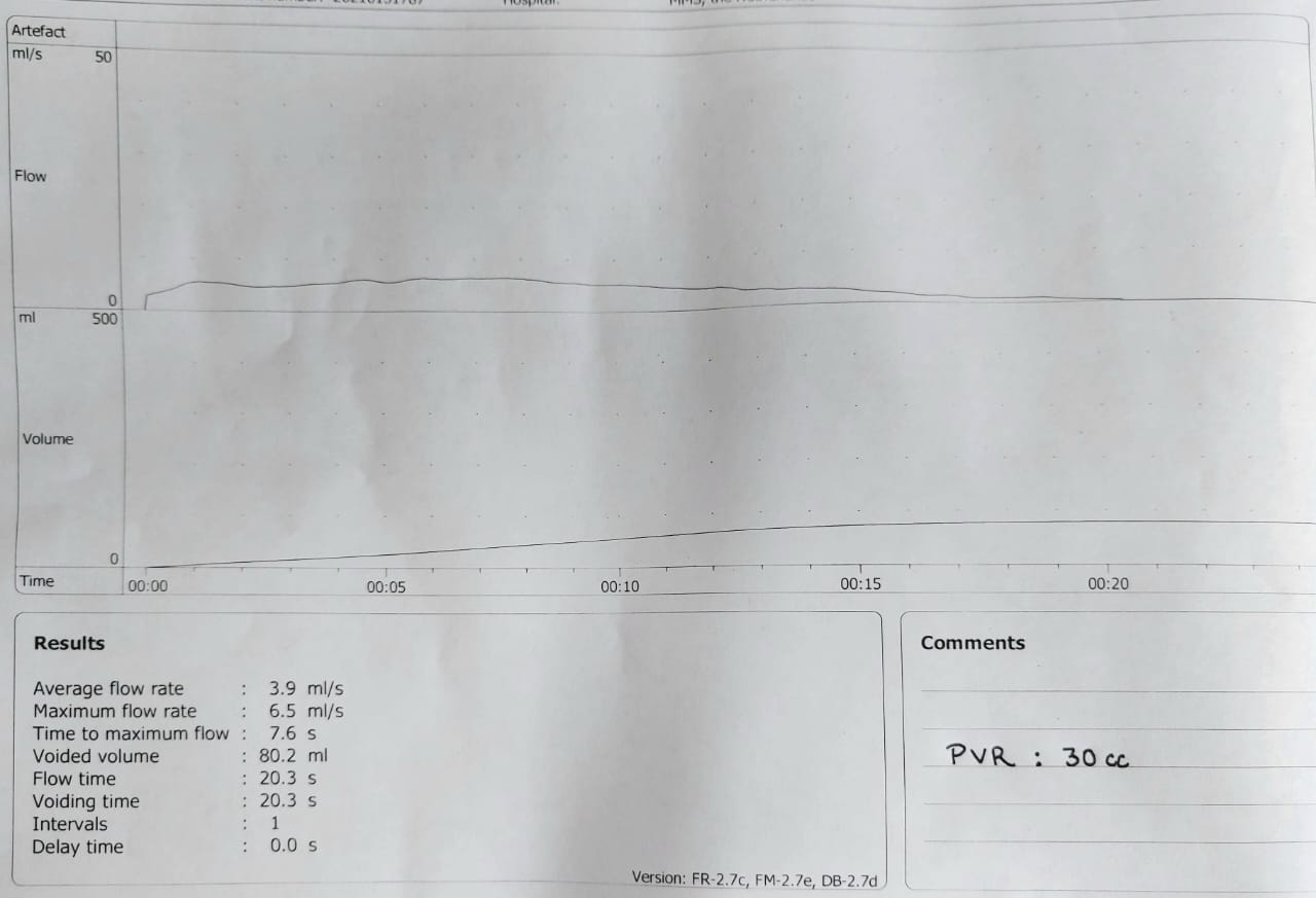 difficult case Fig 2